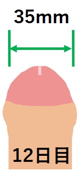キトー君使用12日目