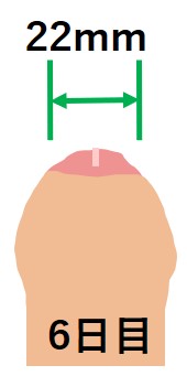 キトー君使用6日目