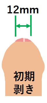 キトー君使用初期剥き状態
